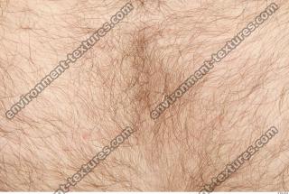human skin hairy 0018